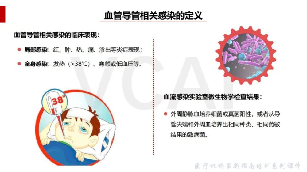 ppt血管导管相关感染预防与控制指南2021版解读