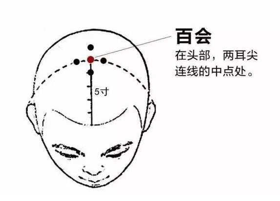百会穴在什么位置?
