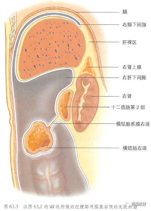 腹膜和腹膜腔解剖图谱