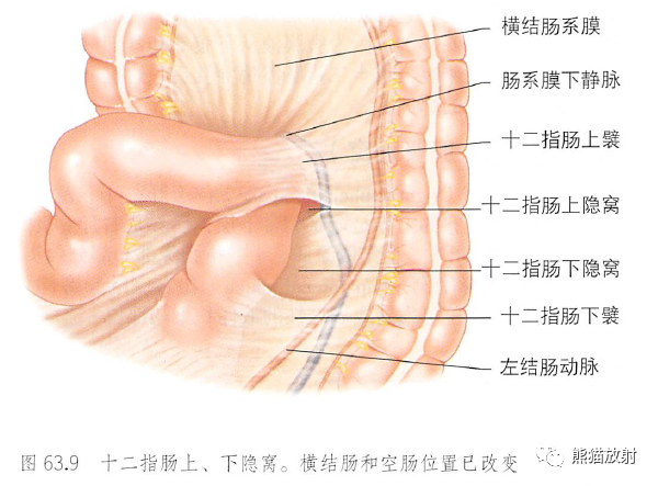 腹膜和腹膜腔解剖图谱