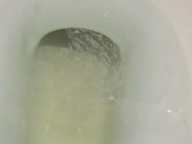 3.白色有絮状悬浮物常提示尿路感染或血尿.2.