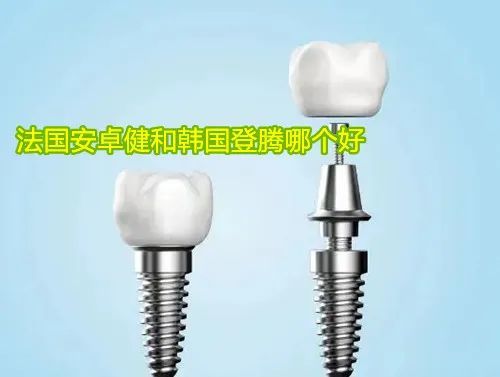 先来简单介绍一下法国安卓健植体和韩国登腾植体~法国安卓健种植体是