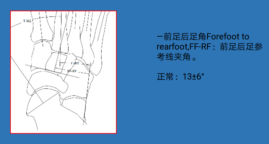 骨科精读图文结合足踝部常见x线测量技巧赶紧收藏