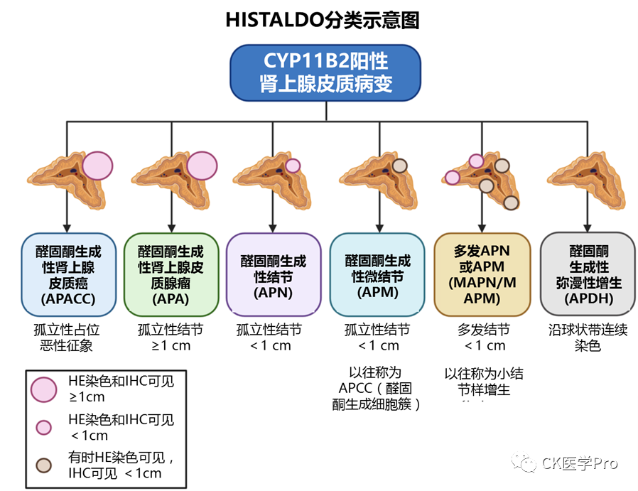 指南共识l2022who肾上腺皮质肿瘤概述原发性醛固酮增多症分类更新