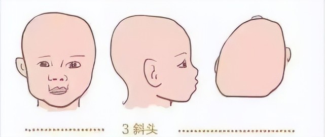 宝宝|林峰|张馨月