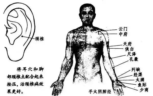 有颈椎病的人颈椎都有筋结把筋结揉散就能立即缓解