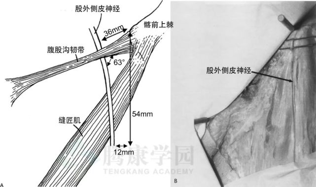 股外侧皮神经在髂前上棘内侧腹股沟韧带处通过,与腹股沟韧带平均产生