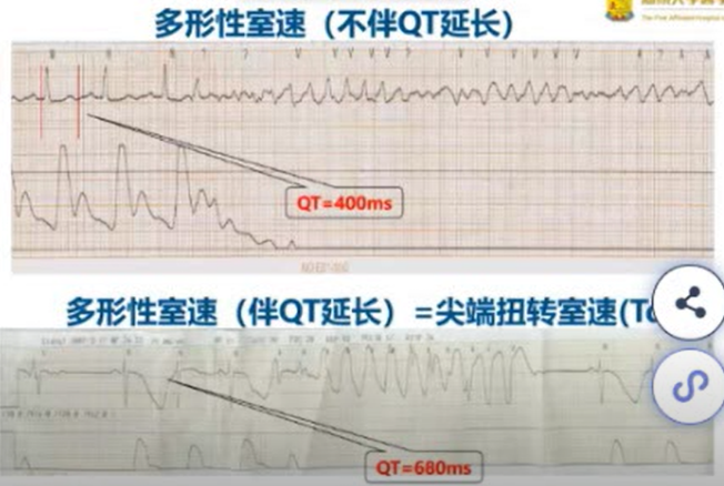 需要迅速发现失代偿性心衰缺氧以及对于抗心律失常药物不依从等情况