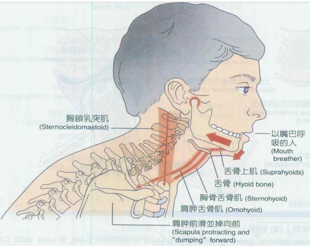 比如颈椎过度前伸,颈前部的肌肉就会将下颌骨向下向后拉,导致颞下颌