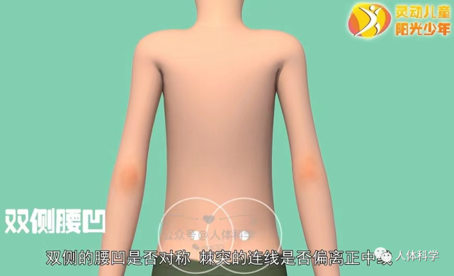 棘突的连线是否偏离正中线双侧的腰凹是否对称肩胛下角是否等高左右