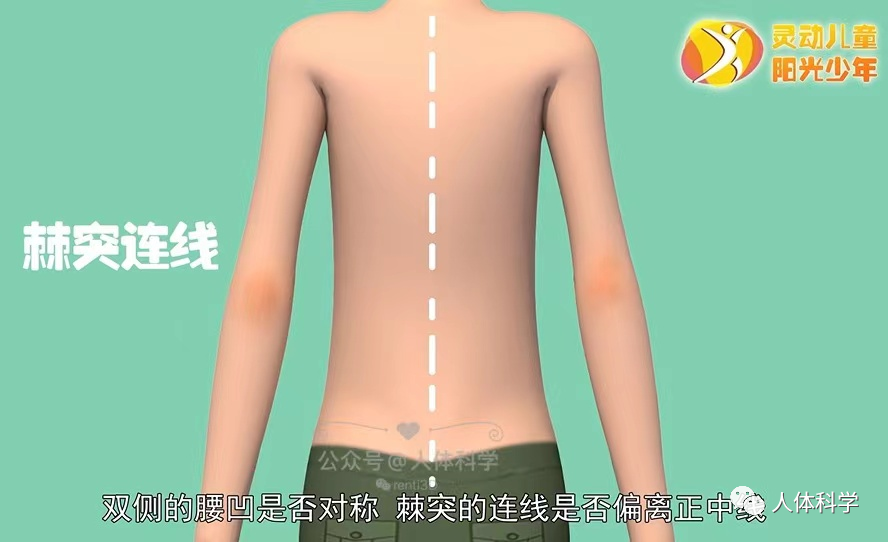 棘突的连线是否偏离正中线双侧的腰凹是否对称肩胛下角是否等高左右