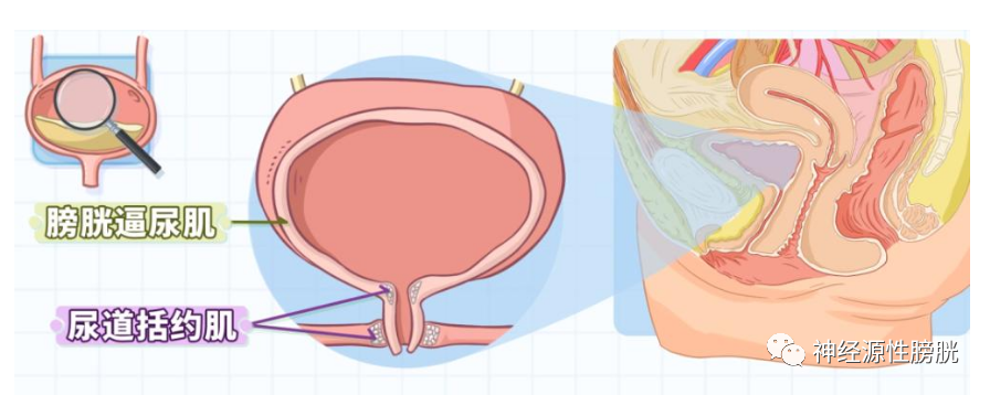 神经源性膀胱的症状表现