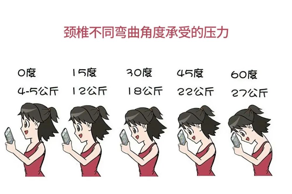 成都治疗颈椎病医院不是所有颈部不适都是颈椎病长骨刺落枕小心误诊误