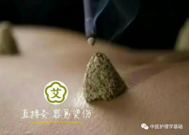 根据施灸程度的不同分为瘢痕灸和无瘢痕灸.