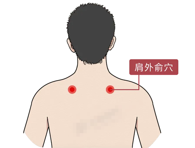 肩外俞肩背疼痛颈项强急