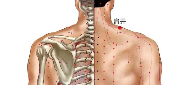 让罐体的红外线及磁场刺激该穴位,可预治肩酸痛,头酸痛,肩部僵硬,落枕