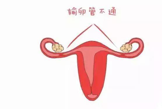 兰州天伦医院教你辨别