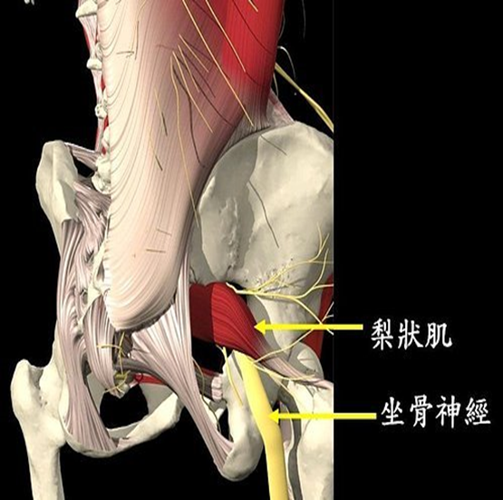 s:坐骨神经;stl:骶结节韧带;p:梨状肌;sg:上孖肌;oi:闭孔内肌;ig:下孖