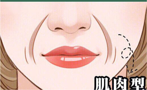 眼轮匝肌,部分横向鼻肌,提上唇鼻翼肌,提上唇肌,颧小肌以及降口角肌等