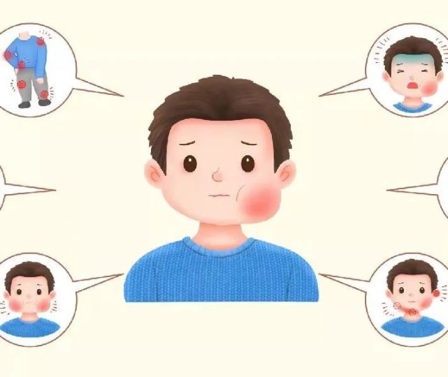 流行性腮腺炎易感人群:水痘在任何年龄阶段的人群都有可能感染,没有