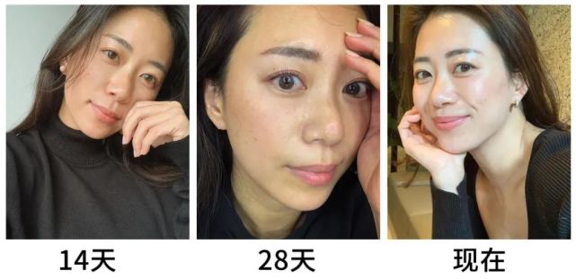 皮肤科专家:有一种精华水,16天可提亮淡斑,可惜很少人