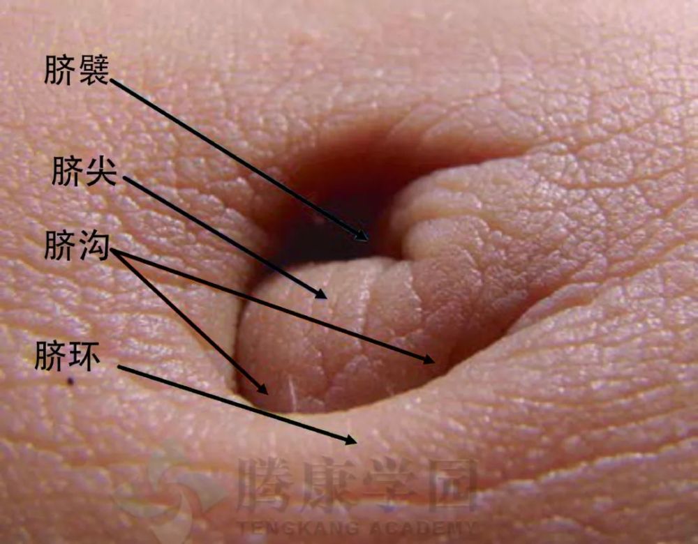 脐沟:脐襞内部和围绕脐尖的凹陷,可能不止一个.
