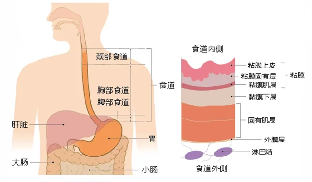 在食道解剖图上,可以观察到,食道黏膜有多层,黏膜比较容易受到损伤