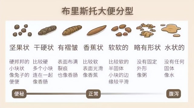 健康的大便需要满足7点,符合5点已经超神,完全符合的