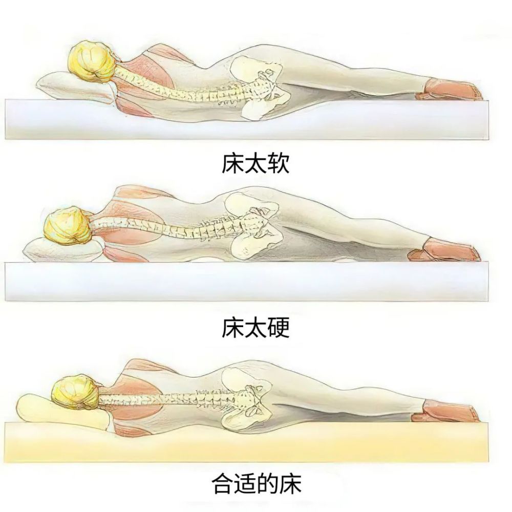 成都腰间盘突出比较好的医院有人说腰椎间盘突出症