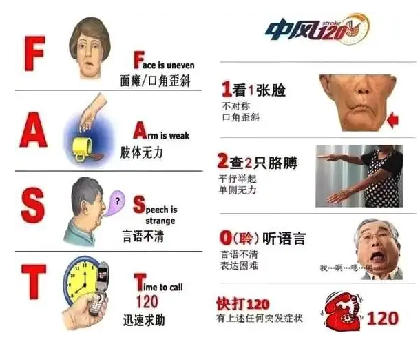 "中风120"口诀"1"代表"看到1张不对称的脸.