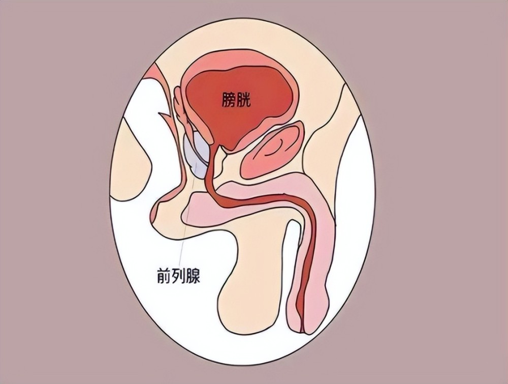什么信号提示前列腺增生需要干预了?本文告诉你_腾讯新闻