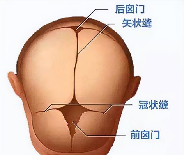 这个病又称"狭颅症",主要由于囟门或者是骨缝提前闭合,从而导致颅腔