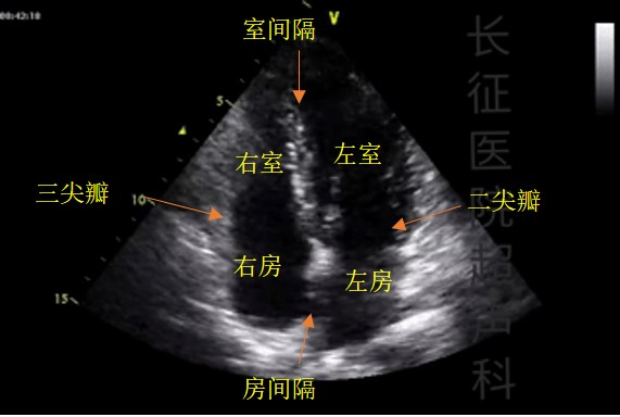 心内科常用检查项目,这么解释一看就懂!