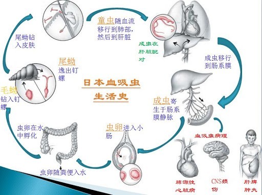 日本血吸虫病的生活史血吸虫病进入晚期后,人们会出现异常消瘦的情况