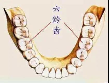 六龄齿也叫"第一恒磨牙,是指儿童生长的第1颗恒磨牙,即第一大臼齿