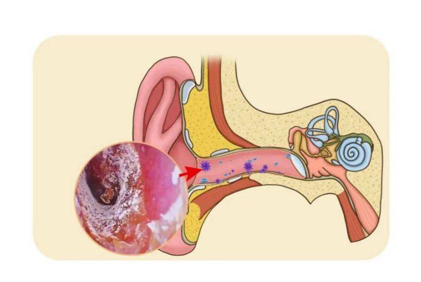 耳朵总是奇痒无比究竟是怎么回事