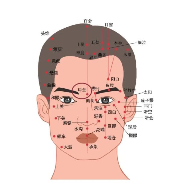 轻刮颈部,脊柱两侧夹脊穴,胸胁部,肘窝及胭窝等处,刮至皮下出现紫斑