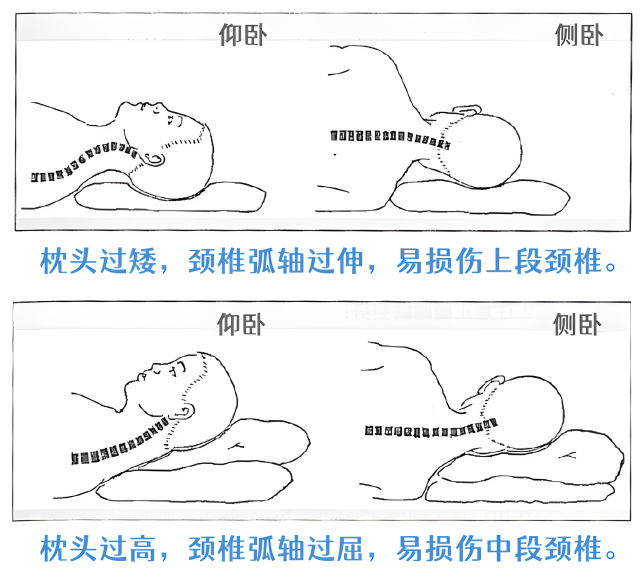 肌肉处于放松状态,如果长期使用高度不合适的枕头,会使颈椎某处屈曲