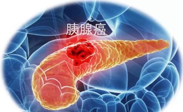 一个儿子的泣血记录老人确诊胰腺癌和病魔争斗不到15个月后离世