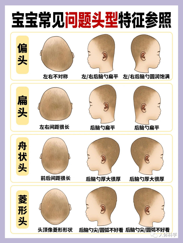 宝宝头型教你如何睡出小圆头常见正常问题头型特征