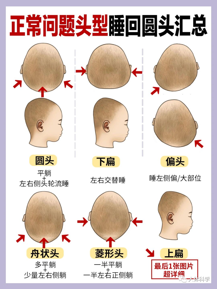 侧面大小不一样,一边圆润好看,一边扁平垂直扁头头窄后宽,头型前面