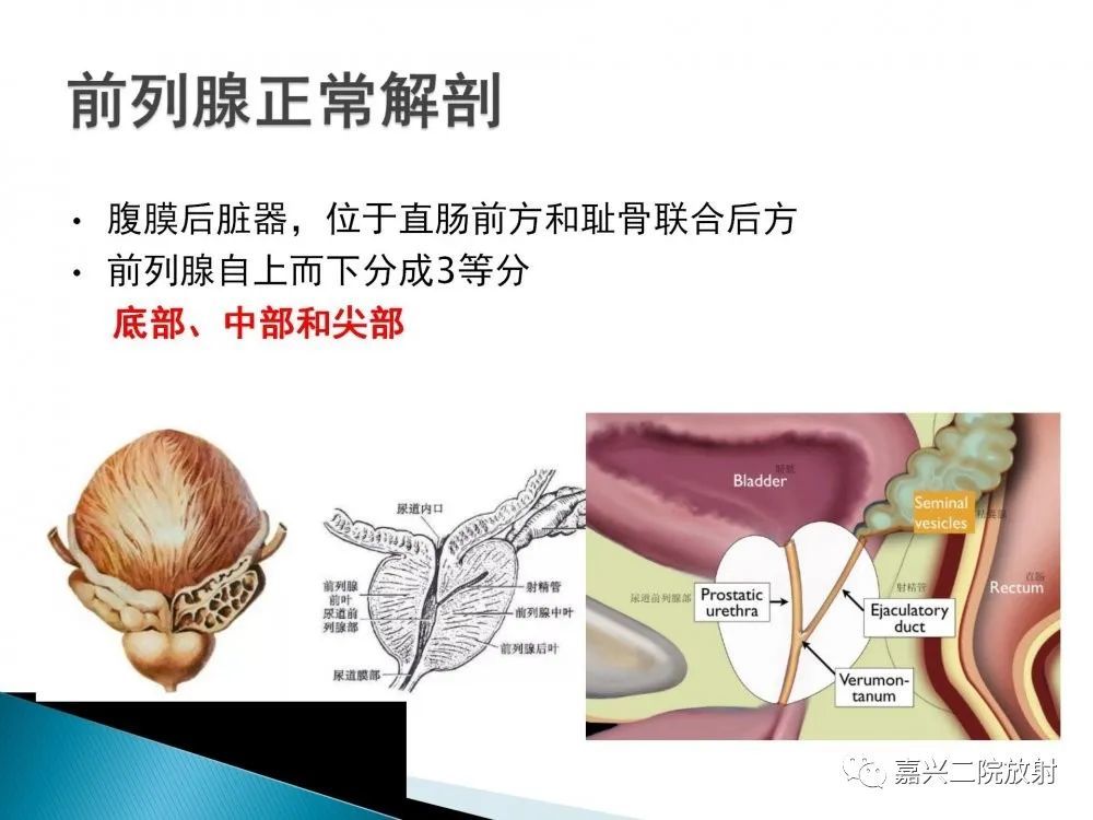 前列腺解剖分区及piradsv21版解读