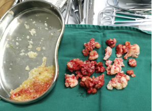 ƹ֢Ʒ_ƹ֢_ƹ֢ʲôĻϥ