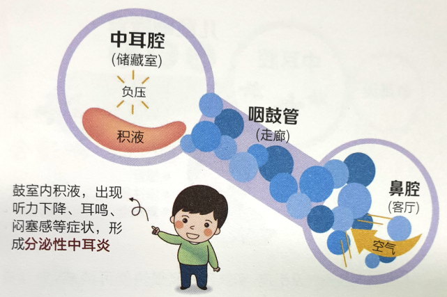 化脓性中耳炎|鼻炎|咽鼓管|鼻腔
