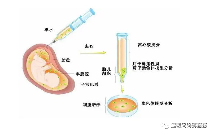 传说中的羊水穿刺让我们一起凑近瞅瞅