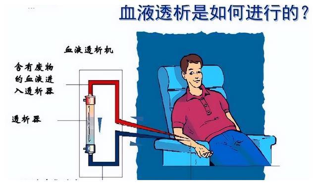 得了尿毒症,透析能延续多长寿命?临床研究:大多在这段时间内