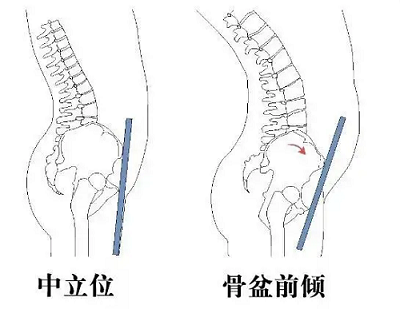 直乐大讲堂小肚腩总甩不掉当心骨盆前倾盯上你