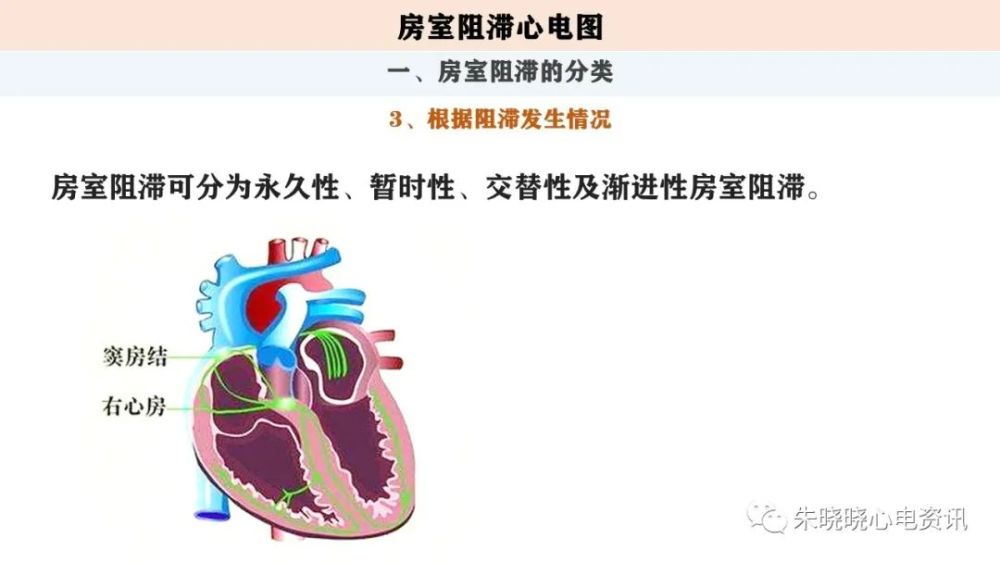 房室 腾讯网