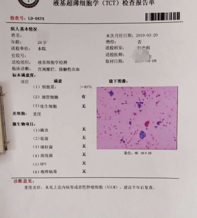 薇润百科分分钟教你会看tct报告单女性要知道