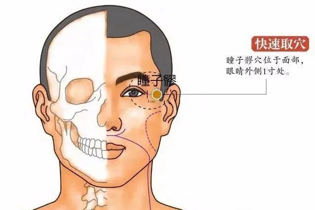 采用正坐或仰卧的姿势,瞳子髎穴位于面部,眼睛外侧一厘米处(目外眦旁